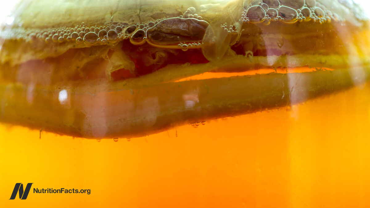 Should We Drink KombuchaΒ Should We Drink KombuchaΒ