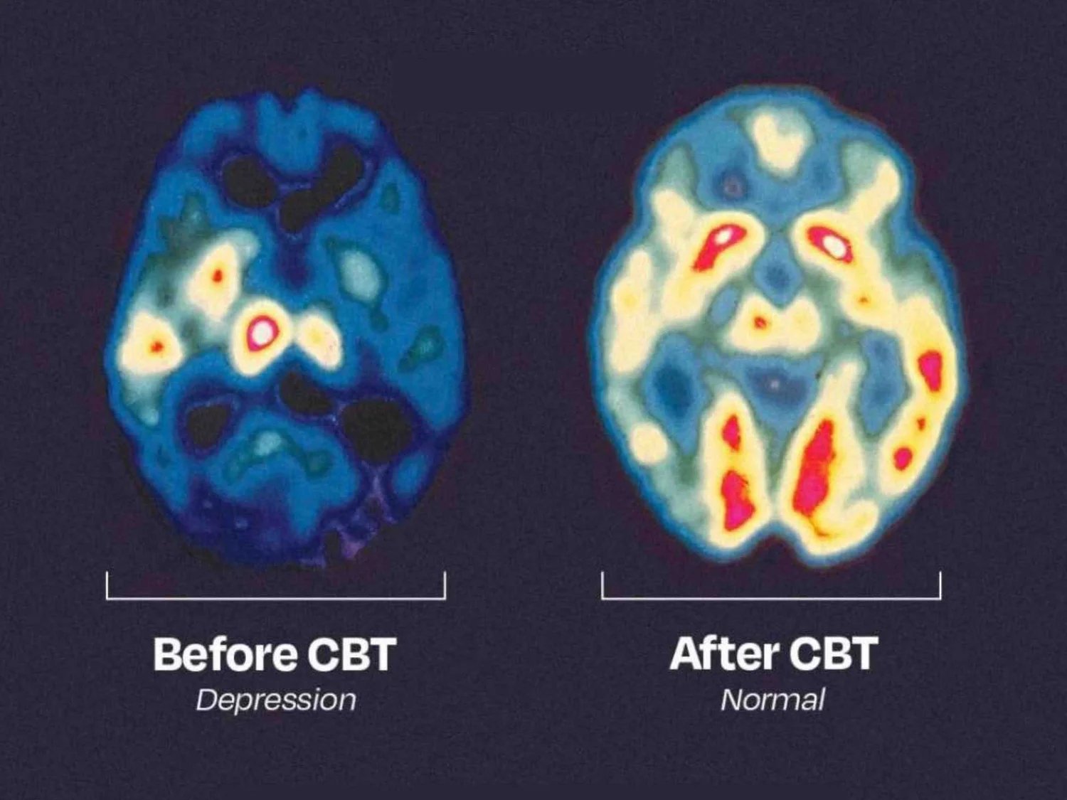 Did You Know That Mindfulness Uses CBT? — Kate Greenslade