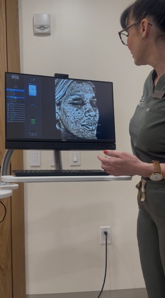 This Laser Treatment Gave My 47-Year-Old Skin Its Glow Back This Laser Treatment Gave My 47-Year-Old Skin Its Glow Back