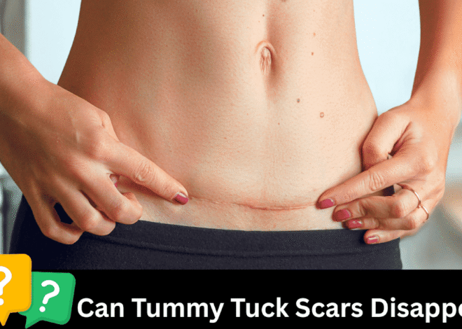 Do Tummy Tuck Scars Disappear—Or Can They Become a Masterpiece?