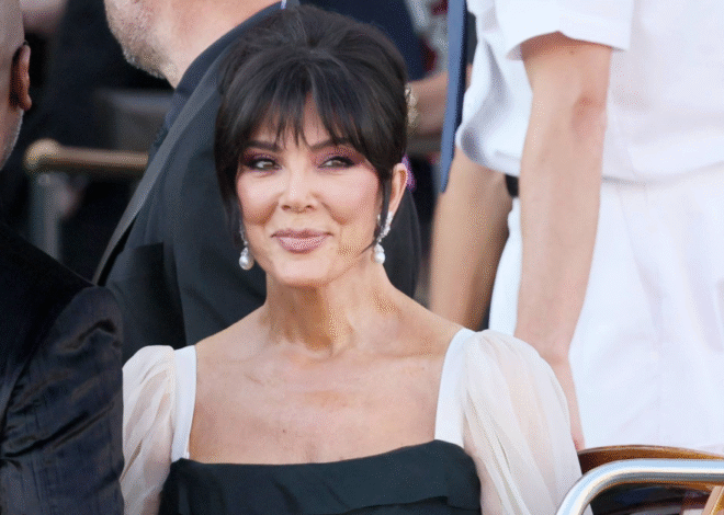 Why You Can’t Order the Kris Jenner Facelift