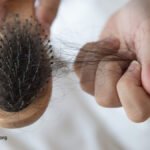 Preventing Hair Loss and Promoting Hair Growth