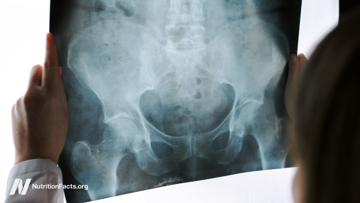 Pelvic Exams by Med Students on Anesthetized WomenΒ Pelvic Exams by Med Students on Anesthetized WomenΒ