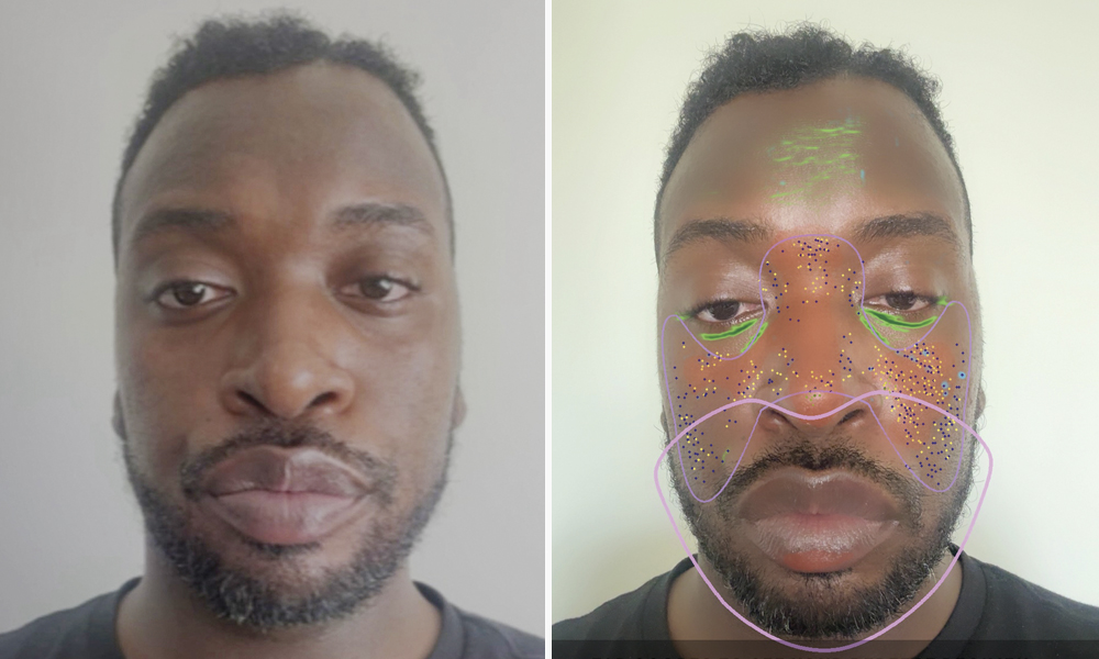 I Let AI Diagnose My Skin—Here’s What it Got Right and Wrong