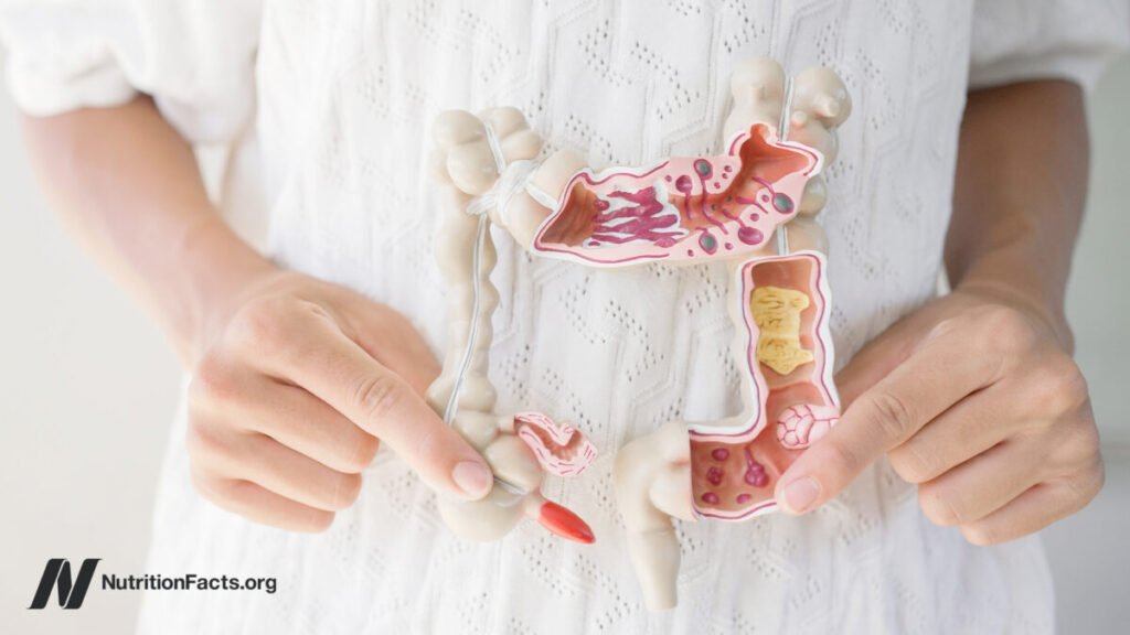 What foods help leaky gut?